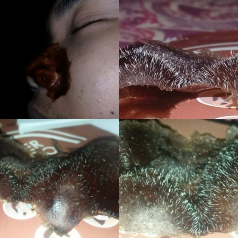 MASKOM. Masker komedo Hamdalah