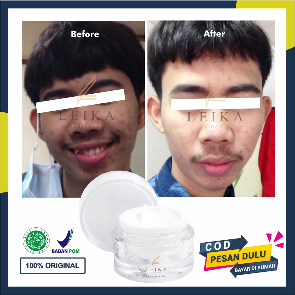 TERBUKTI AMPUH Cream Pemutih Wajah Pria BPOM Original Krim Pemutih Wajah Pria Cowok Laki2 Krim Pemut