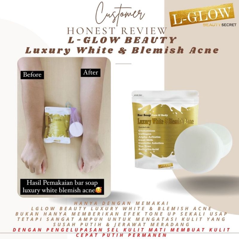 LGLOW BEAUTY BAR SOAP LUXURY WHITE BLEMISH ACNE AHA SABUN PEMUTIH BY L GLOW REFLISKIN