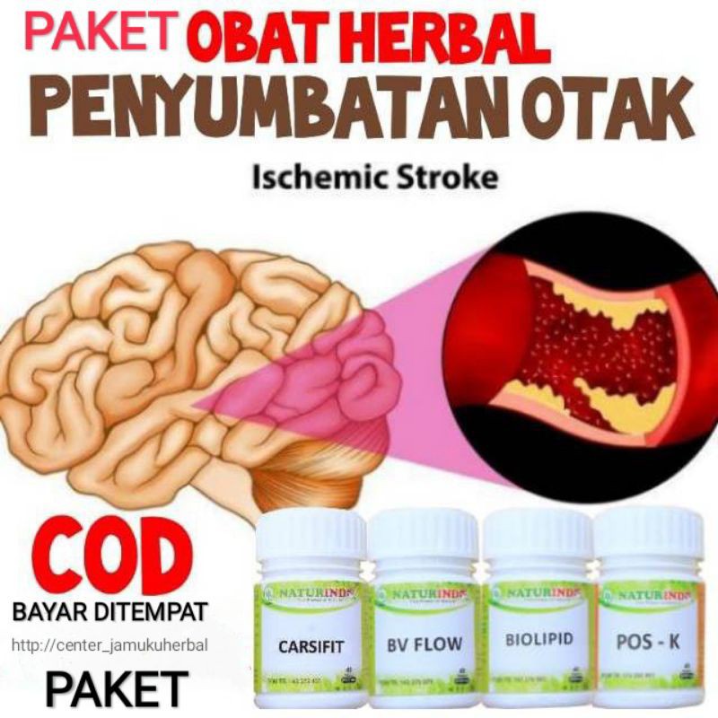 PAKET OBAT HERBAL SETEROK STROKE.PENYUMBATAN OTAK NATURINDO