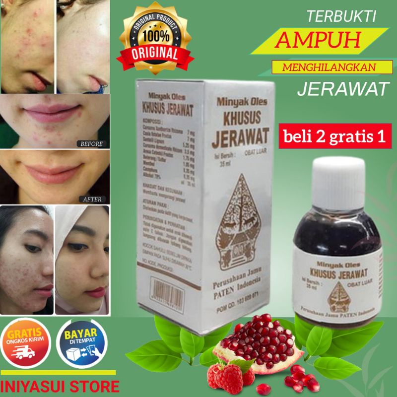 Obat jerawat dan bekas jerawat penghilang bekas jerawat obat totol jerawat obat menghilangkan bekas 