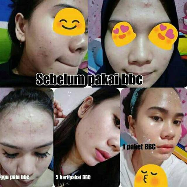 [BISA COD] BEBWHITE C SKINCARE / BBC