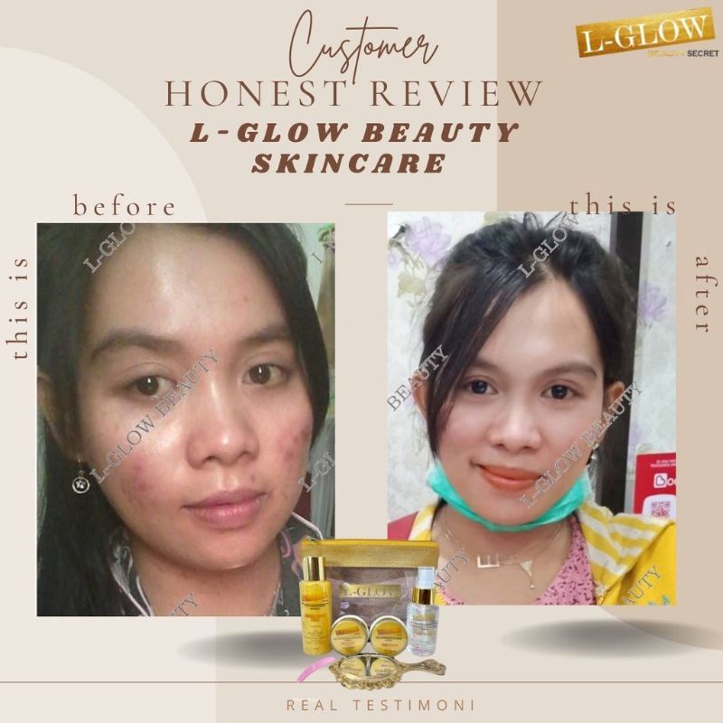 LGLOW BEAUTY SKINCARE BB GLOW DAY NIGHT CREAM GLUTA AHA SERUM LOTION BAR SOAP PEELING WHITE LUXURY