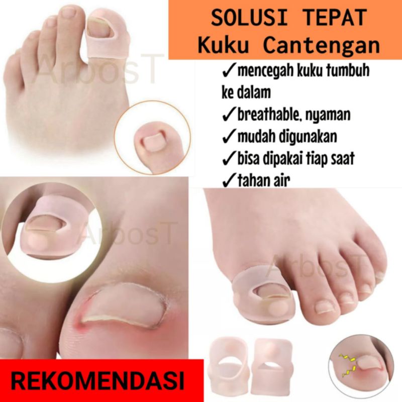 Alat Koreksi Kuku Kaki Tumbuh Ke Dalam Silikon Elastis Cantengan Cantengen Paronikia Paronychia