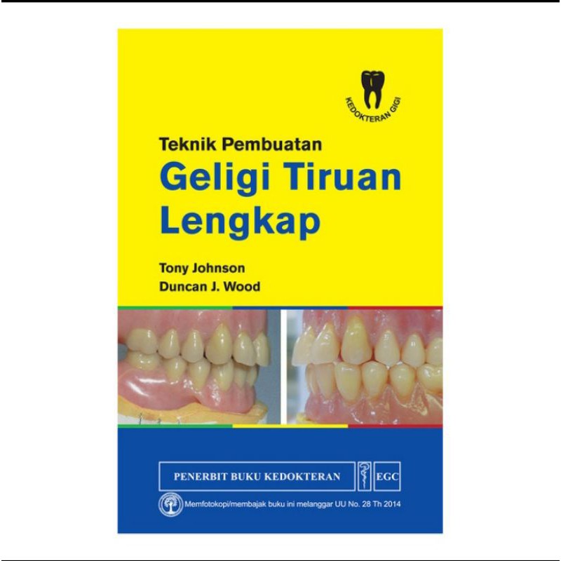 Teknik Pembuatan Geligi Tiruan Lengkap