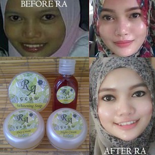 EXLUSIVE RA GLOW (satu set)/ CREAM PEMUTIH WAJAH RACIKAN DOKTER PEMUTIH AMAN PALING MURAH