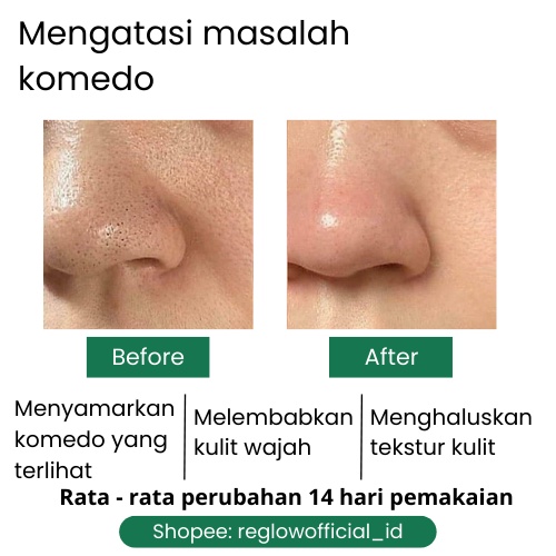 Reglow Dr Shindy Putri Skincare Ori Wajah Glowing Cream Flek Hitam Kusam Facial Wash Bruntusan Berminyak Dan Berjerawat Toner Whitening Centella Reg glow Original Official Store