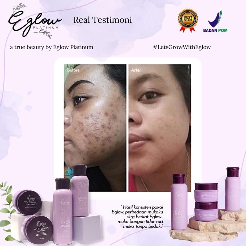 EGLOW PLATINUM KEMASAN BARU [Free Parfum]