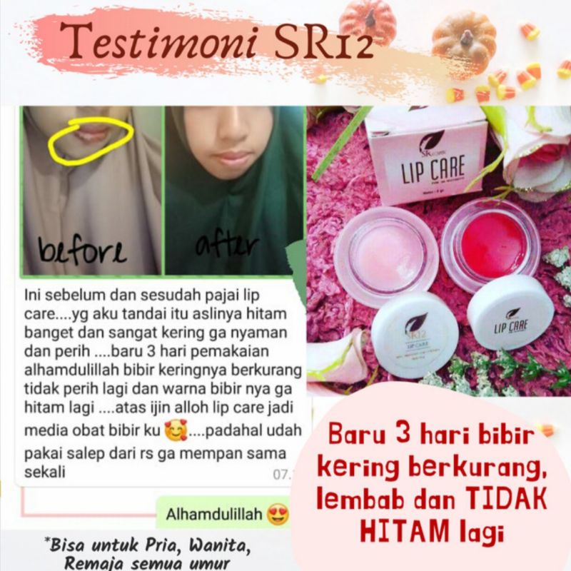 LIP CARE CHERRY SR12 / PEMERAH BIBIR PERMANEN / LIP BALM / PELEMBAB BIBIR / LIPCARE SR12 / PENCERAH BIBIR HITAM / LIP CARE BERKUALITAS / PERAWATAN BIBIR / LIP CARE ORIGINAL / LIP CARE BPOM