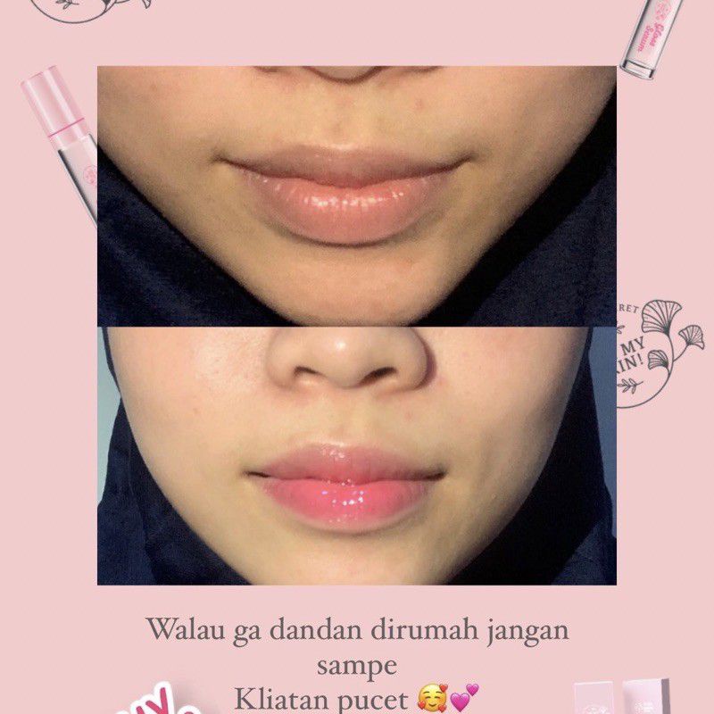 OHMYSKIN! LIP and GLOSS SERUM (NEW FORMULA)