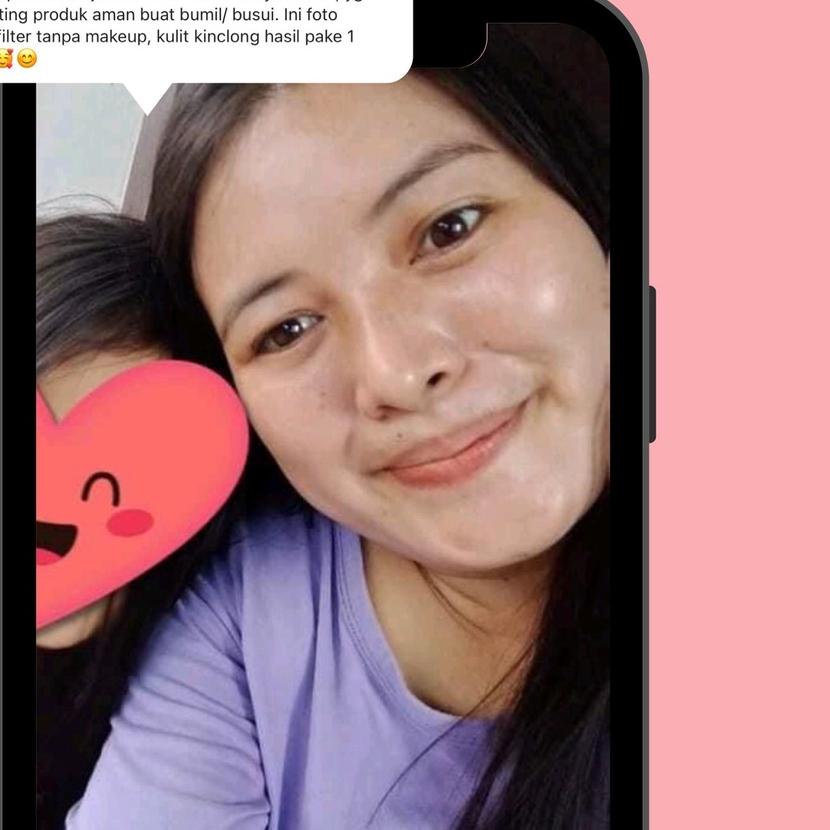 ☈ RESELLER SKINCARE PAKET NORMAL&ACNE GLOW by WAZATARU ✸