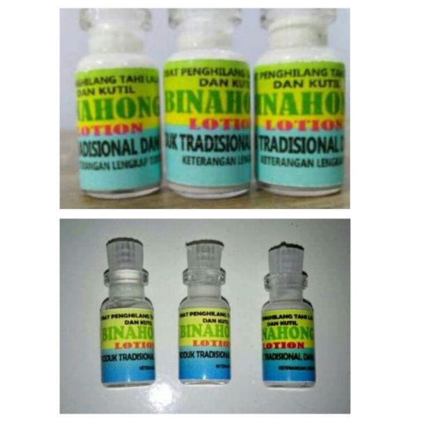 Terlaris Binahong Lotion Penghilang Tahi Lalat Dan kutil Viral