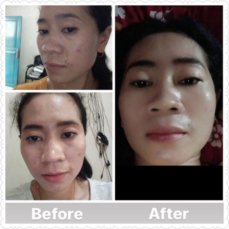 STEV Skincare by STEVIE AGNECIA Paket Glowing Kecantikan Memutihkan BPOM HALAL AMAN ORIGINAL good ok