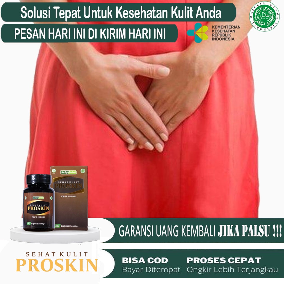 Obat Selangkangan Lecet, Obat Iritasi Selangkangan, Obat Selangkangan Sakit dan gatal, Obat Babak di