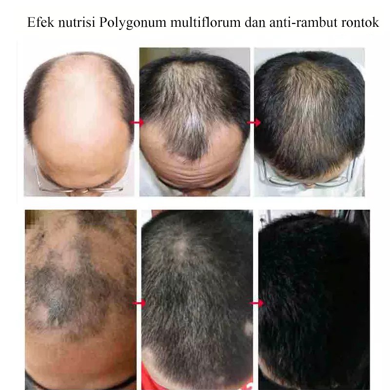 hair tonik 30ml penumbuh rambut/penumbuh rambut botak/serum penumbuh rambut/Memperbaiki folikel rambut/merangsang pertumbuhan rambut/perawatan rambut