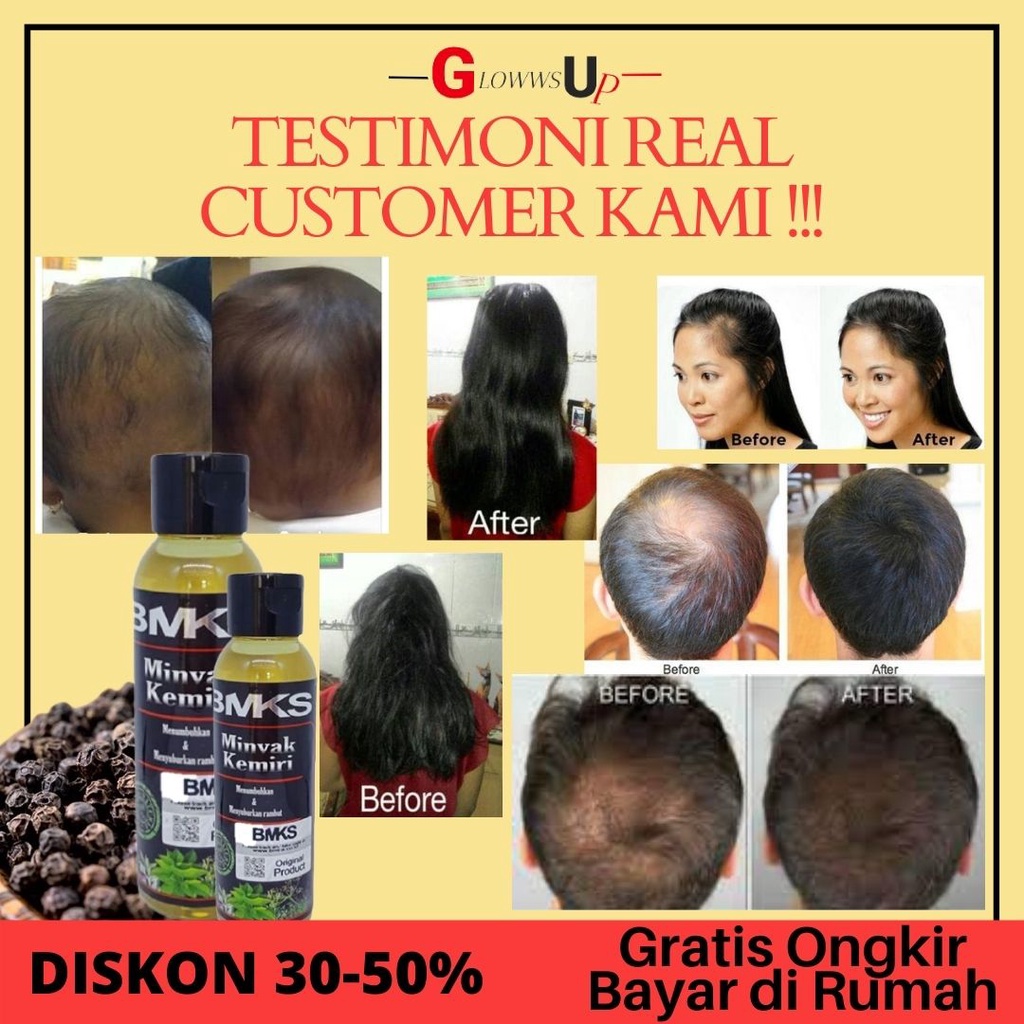 MINYAK KEMIRI BMKS - BMKS KEMIRI OIL PENUMBUH RAMBUT BOTAK TREATMENT RAMBUT