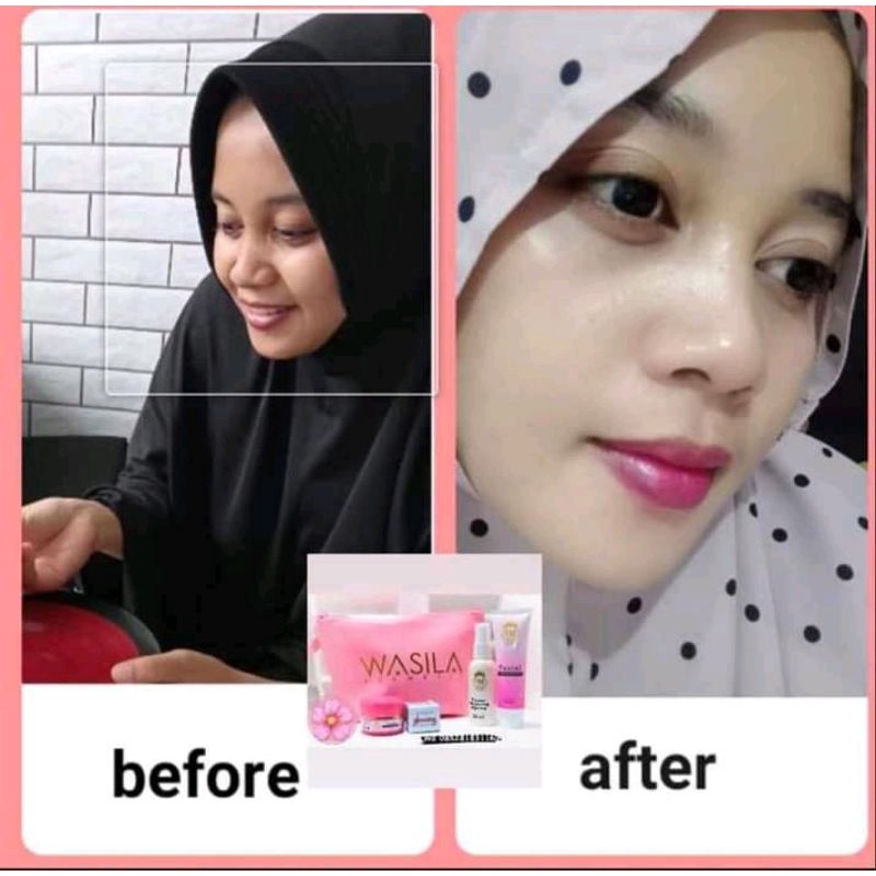 WASILA COSMETIC/ WAVEAUTY
