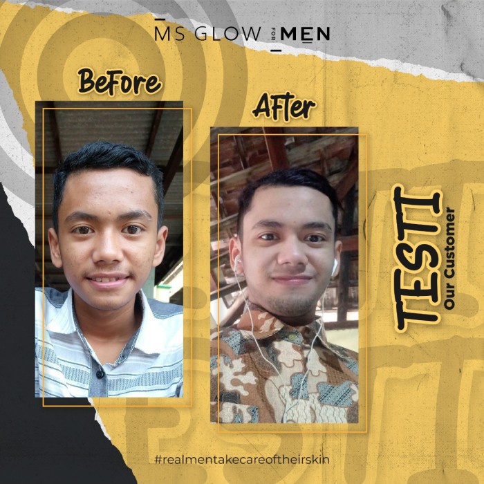 ms glow for men - skincare pria ms glow for men original - paket 4in1 safa