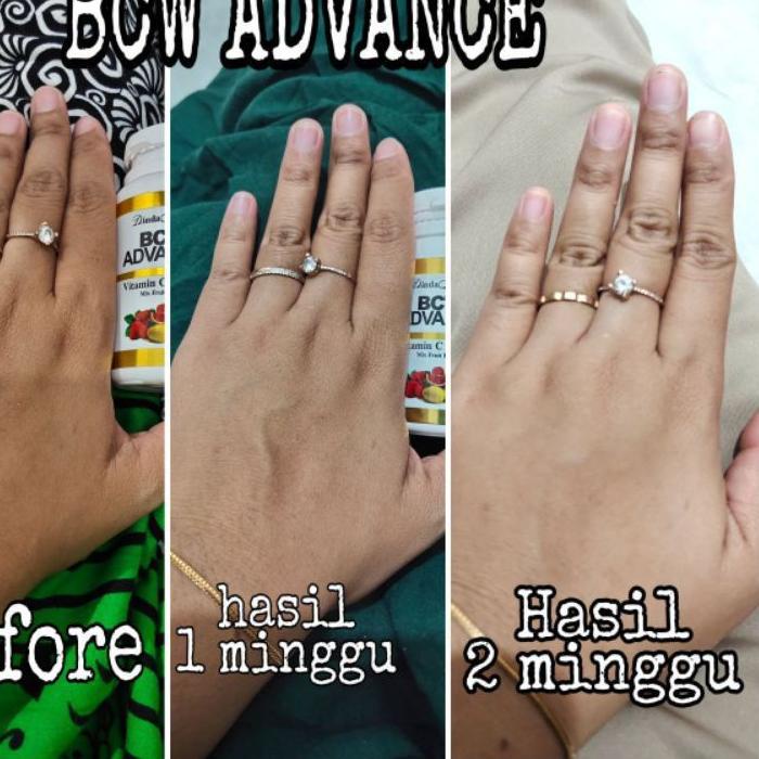 Kekinian - BCW ADVANCE 100% ORIGINAL MALAYSIA TERLARISSSSS