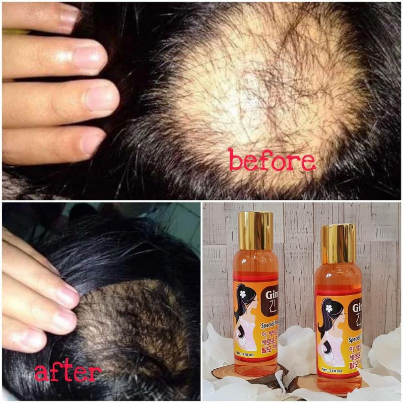 Hair Tonic Red Ginseng Korea Penumbuh Rambut