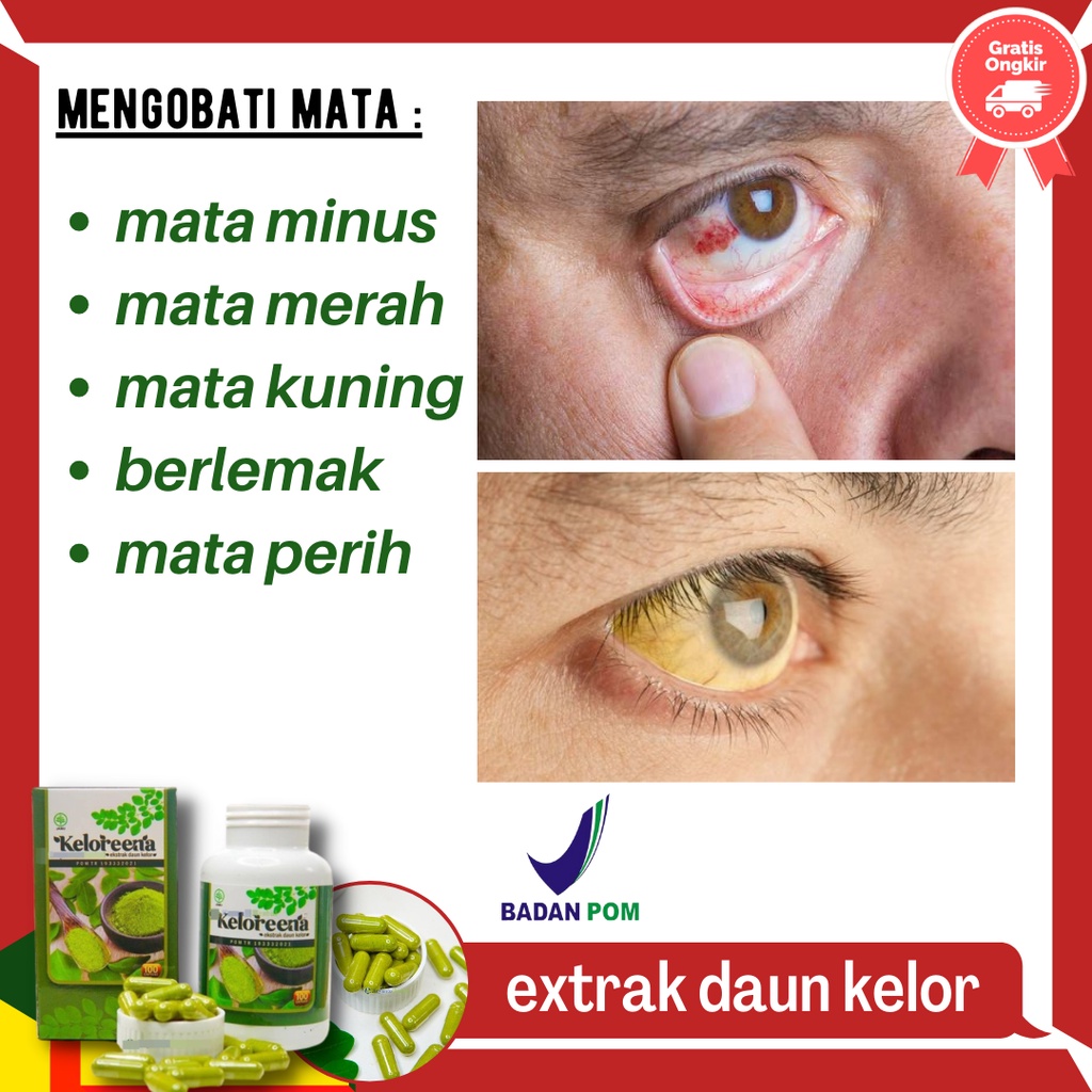 keloreena original obat mata kuning kelorena mata berlemak obat mata berlemak parah obat mata rabun 