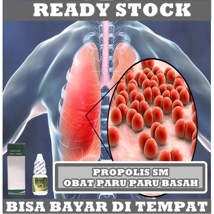 Obat Paru Paru Basah - Obat Asma, Obat Penyakit paru obstruktif kronis (PPOK), Obat Penyakit Paru Interstisial, Obat Hipertensi Pulmonal, Obat Fibrosis Kistik, Obat Pneumonia, Obat Kanker Paru Paru, Obat Tuberkulosis (TBC) Atasi Dengan Walatra Propolis SM