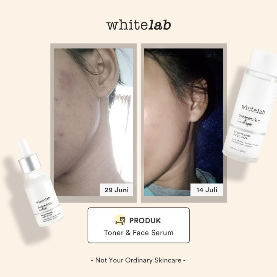 ❤️ Cloudy ❤️ WHITELAB Brightening Face Toner / Soothing Toner