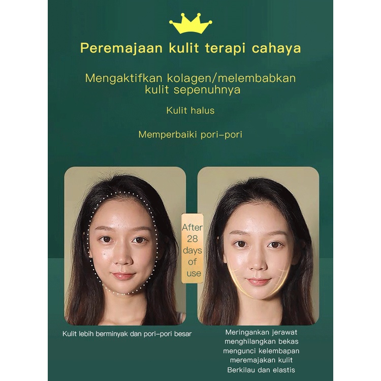 E ONE alat setrika wajah glowing ion 4in1 / setrika wajah penghilang kerutan / alat pijat wajah / alat pengencang wajah