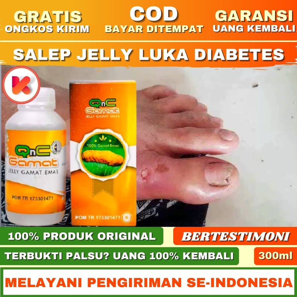 Salep Luka Diabetes Obat Diabetes Obat Herbal Diabetess Obat Luka Diabetes QnC Jelly Gamat