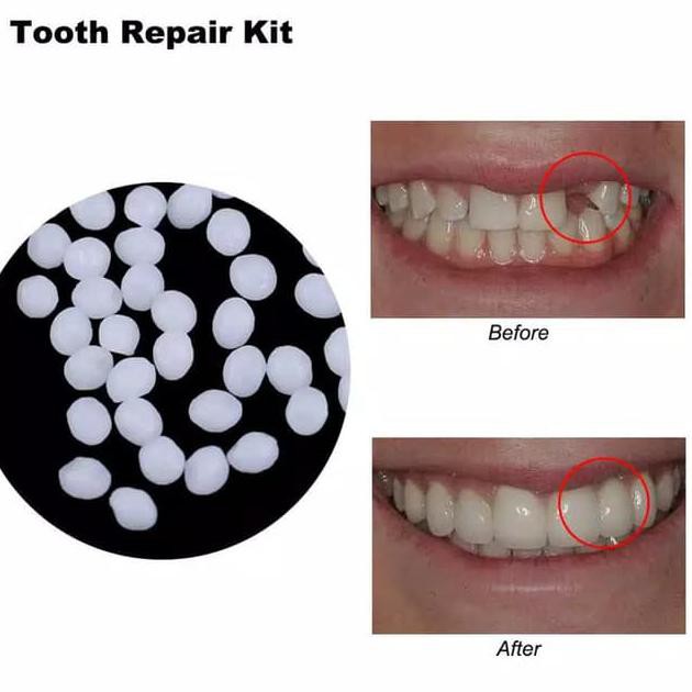 ★ TERHEMAT PEMUTIH GIGI PERMANEN★ LEM GIGI PALSU ,PEMUTIH GIGI WHITE LIGHT PEMUTIH GIGI PERMANEN