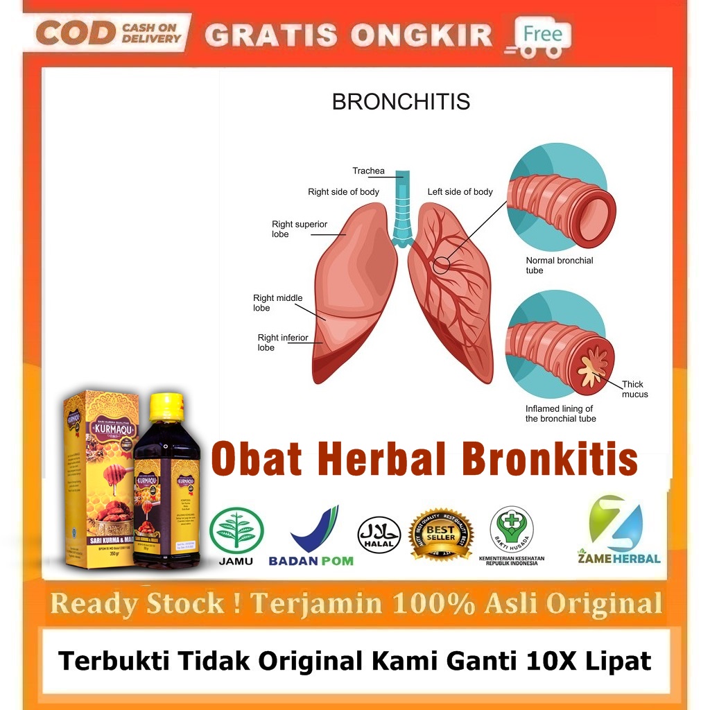 Obat Bronkitis, Batuk Kering Dan Gatal, Madu Batuk Menahun, Obat Batuk Herbal, Batuk Dewasa, Batuk B