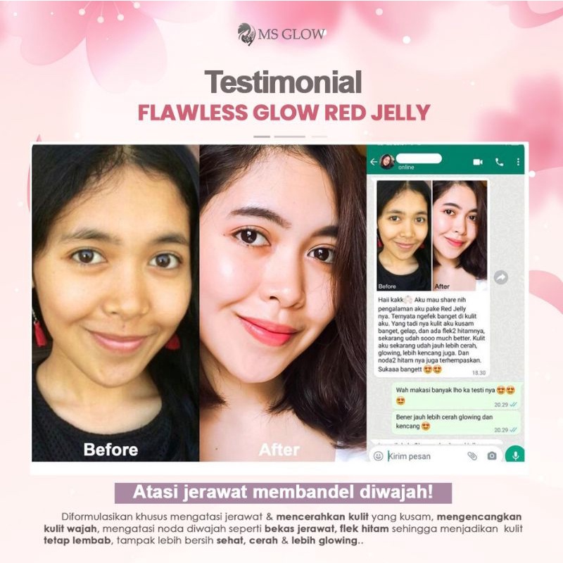 RED JELLY LACTOBACILLUS || MS GLOW