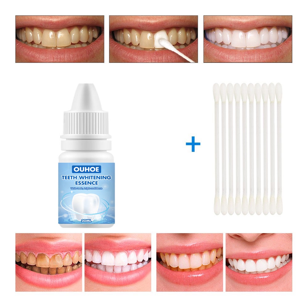 Esensi pemutih gigi Whitening teeth Cairan 10ml Menghapus Noda asap karang gigi kalkulus Kebersihan mulut Esensi pembersih Nada segar