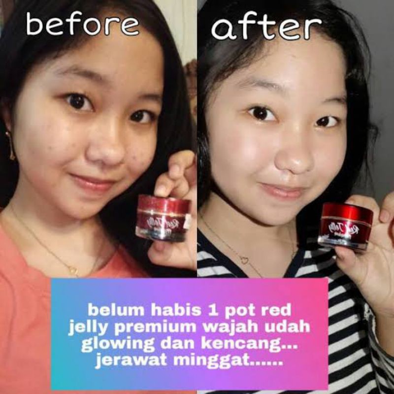 RED JELLY KRIM PENGHILANG JERAWAT MEMBUAT KUKIT BERSIH CERAH GLOWING ORIGINAL BPOM