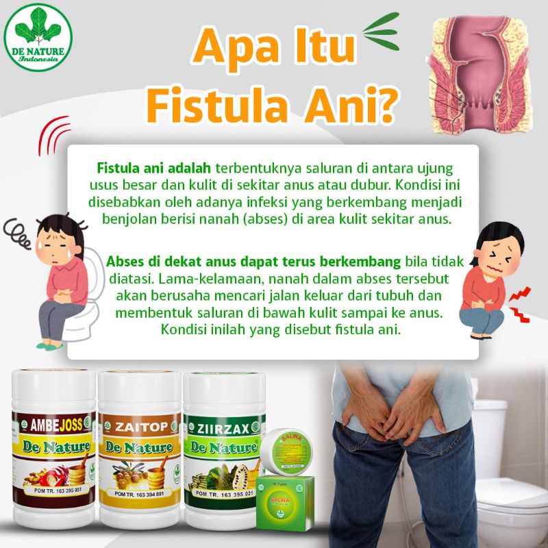 Jual Obat Fistula Ani De Nature Ori Shopee Indonesia 2135