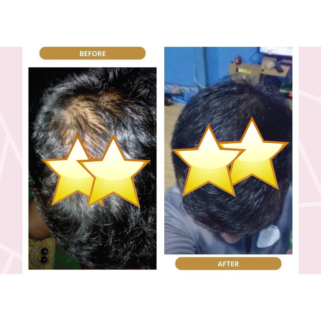 SHAMPO METAL 60ML SAMPO METAL - PENUMBUH RAMBUT - PEMANJANG RAMBUT - PENUMBUH RAMBUT BOTAK