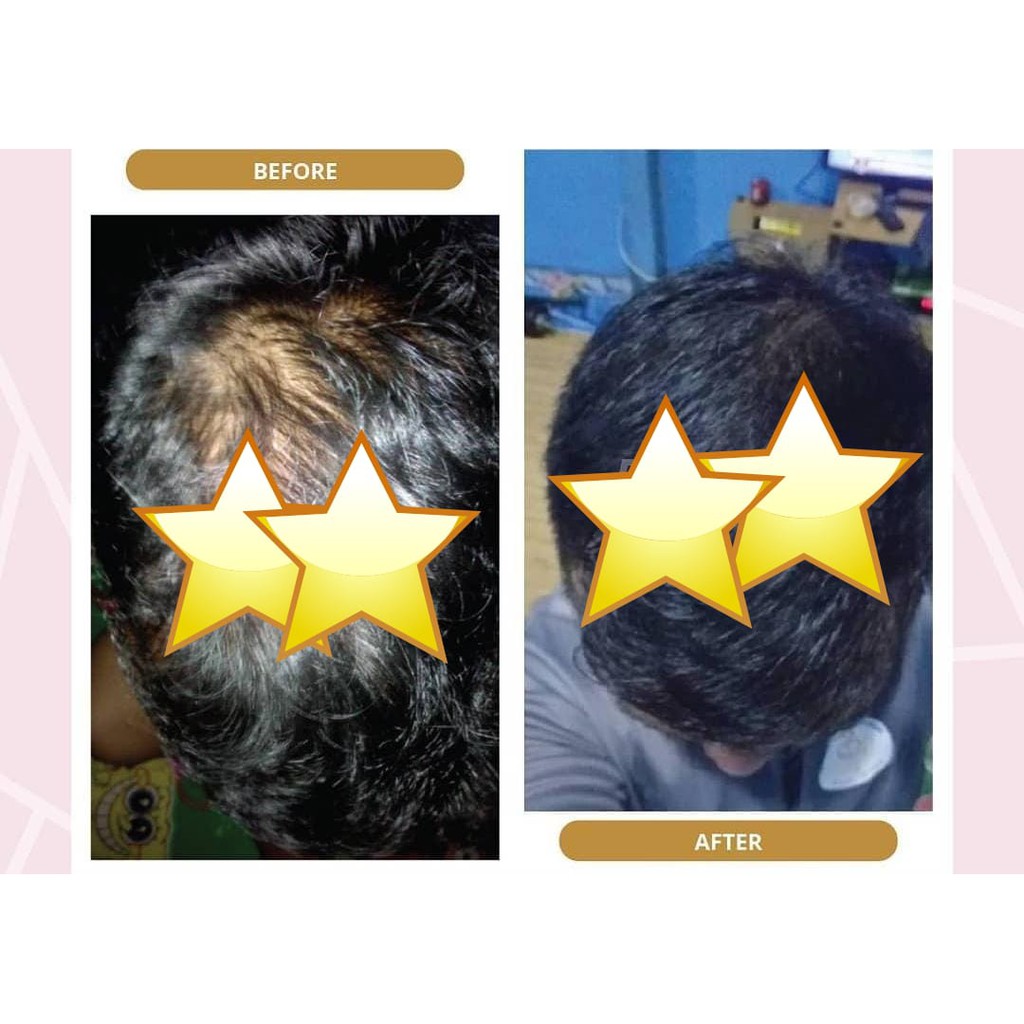 SHAMPO METAL 60ML SAMPO METAL - PENUMBUH RAMBUT - PEMANJANG RAMBUT - PENUMBUH RAMBUT BOTAK