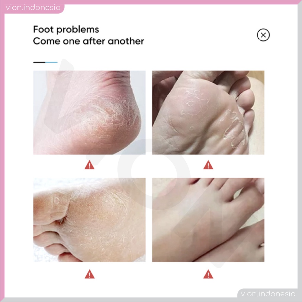 LUOFMISS Foot Mask Moisturizing Repair Dryness Memperbaiki Kering Masker Kaki Original LM002