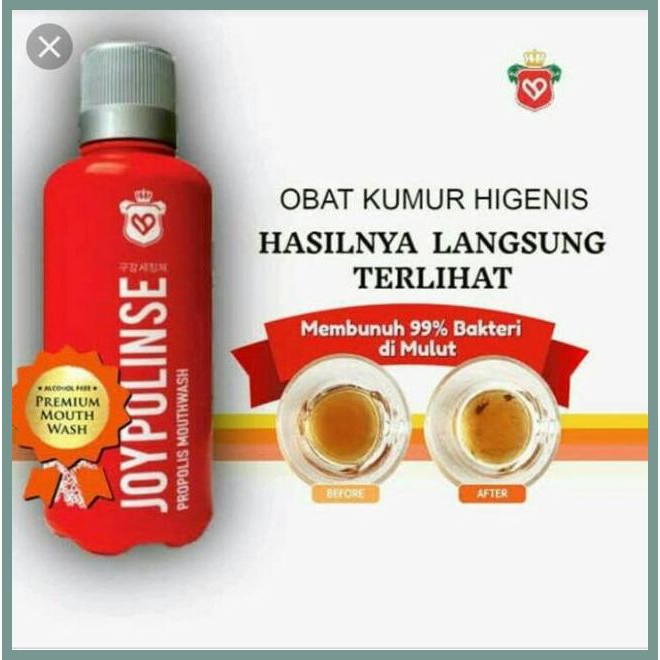 Joypolinse Obat Herbal Bau Mulut Menahun Shopee Indonesia