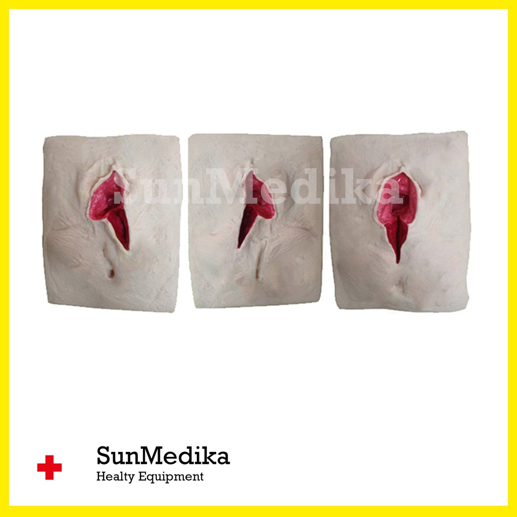 Manekin Episiotomy Model | Manikin Phantom Suture Simulasi Training