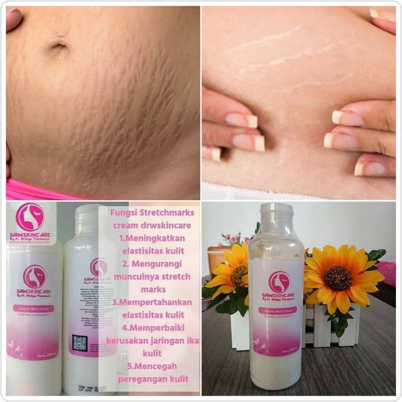 STRETCH MARK/Selulit CREAM DRWSKINCARE