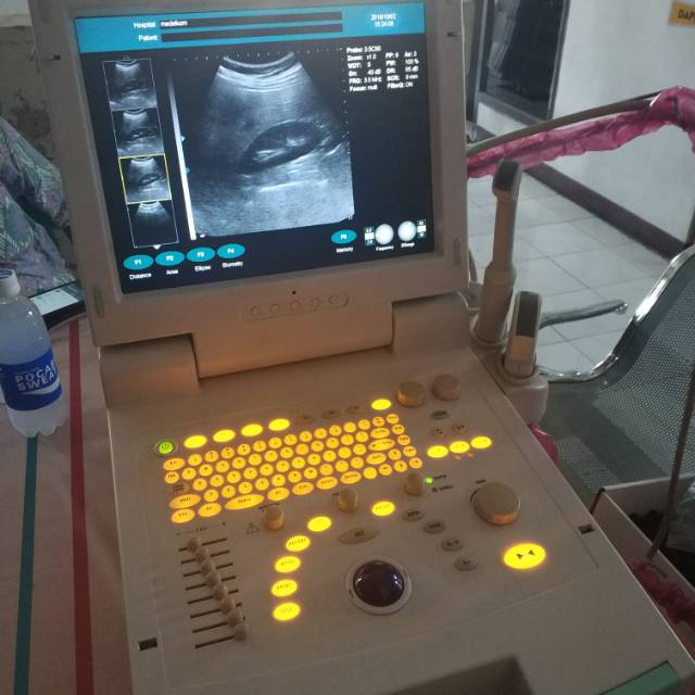 USG 2D Color Doppler