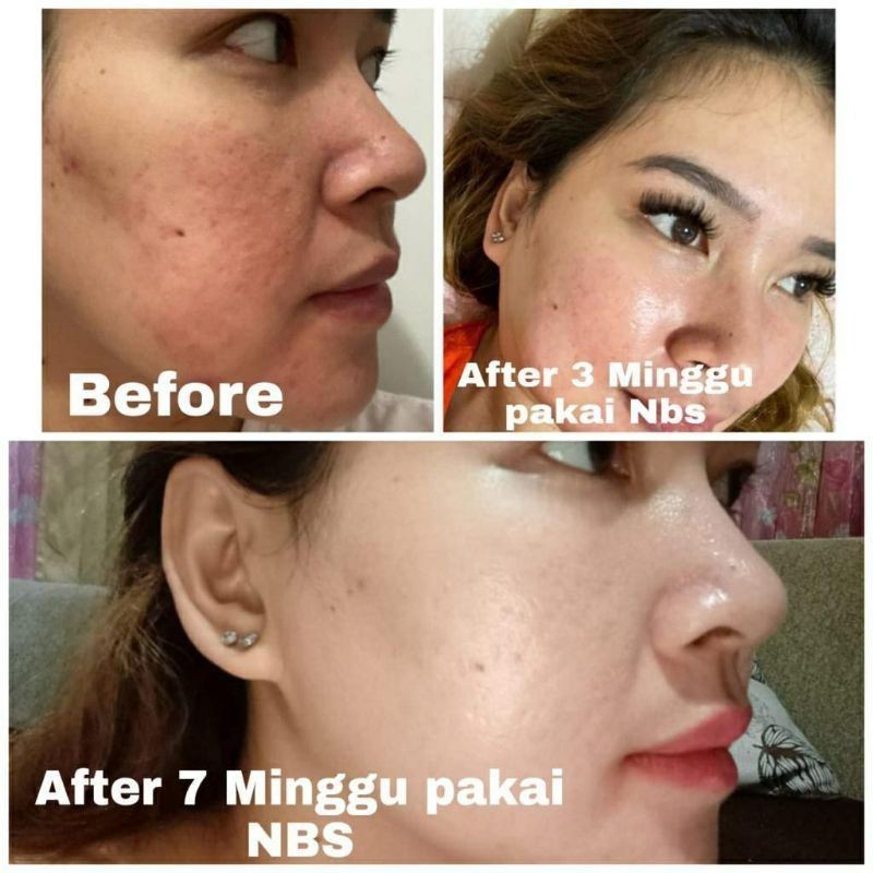 Paket Nbs Ultimate New Glowing Your Healthy Skin paket kecantikan dan pembersih wajah nbs