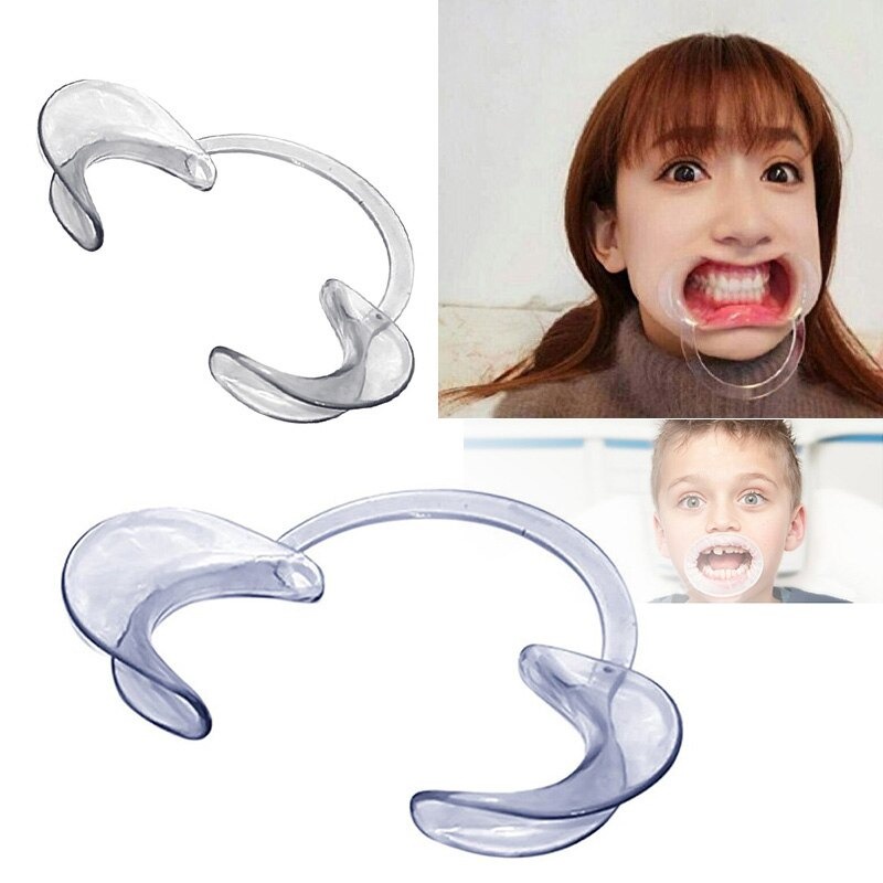 [BISA COD] alat Pembuka Mulut Untuk Pemasangan Behel Alat Pembuka Penyangga Mulut Mouthgate Elastis Anti Pecah Teeth Retractor Mouth Opener Veneer Gigi Behel