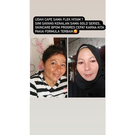 GOLD SERIES DAVIENA SKINCARE//PAKET FLEK/MELASMA-6