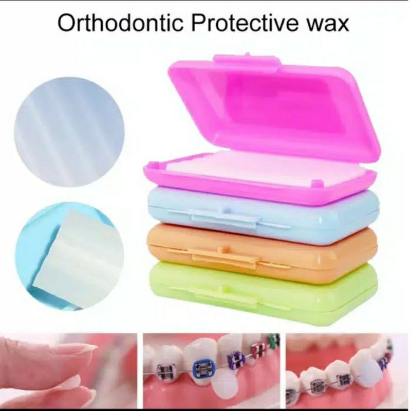 Wax Ortho Anti Sariawan / Lilin Ortho / Lilin Dental Gum Anti Sariawan