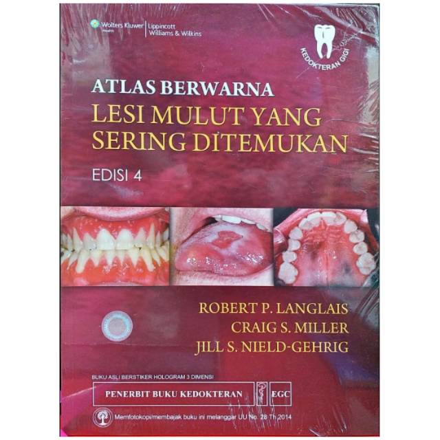 Atlas Berwarna Lesi Mulut Yang Sering Ditemukan Edisi 4 - Robert