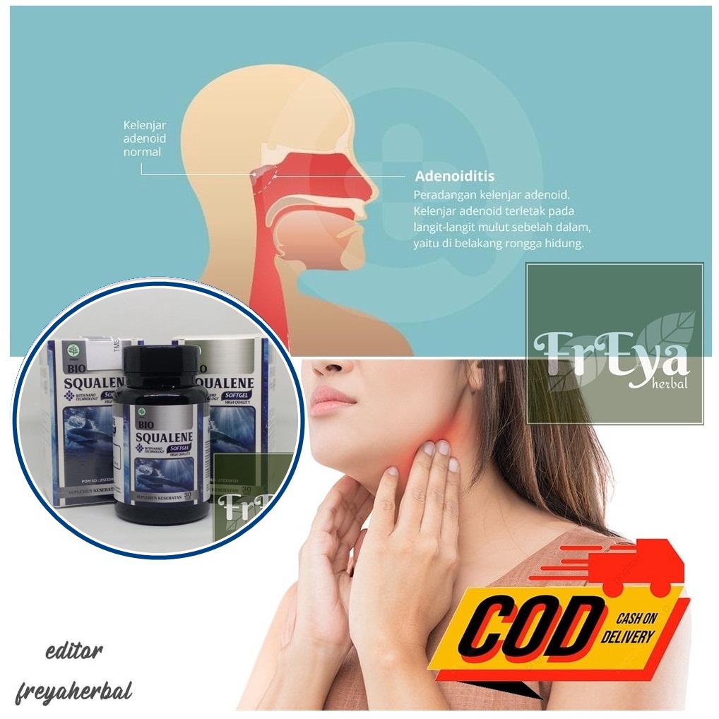 Jual Obat Peradangan Kelenjar Adenoid Adenoiditis Obat Herbal Kelenjar Obat Peradangan Bisa