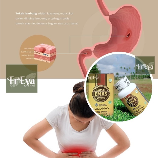 OBAT TUKAK LAMBUNG, OBAT HERBAL ULKUS PEPTIKUM, OBAT ULKUS LAMBUNG, OBAT LUKA LAMBUNG, OBAT SAKIT LA