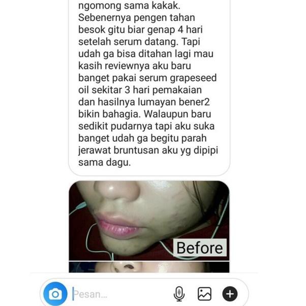 B~A~R~U OP89 SERUM WAJAH SERUM OIL FACE OIL UNTUK DIJUAL KEMBALI RESELLER DELUXE TRIO - BOTANICA BEA